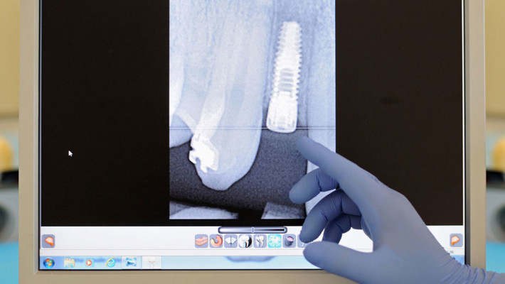 Chirurgia orale e implantare